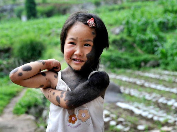 Kurt kızın dramı - Resim: 3