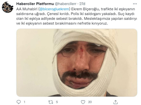 Anadolu Ajansı muhabiri dehşeti yaşadı! Yüzüne onlarca dikiş atıldı - Resim: 0