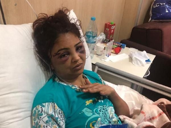 Maaşını vermeyen imam nikahlı eşe feci dayak - Resim: 4