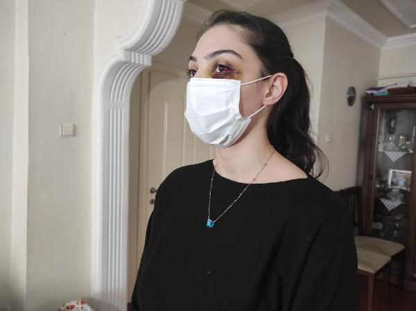 Telefonda video izlediği için kocasından dayak yedi: Ölmeyi mi bekleyeyim? - Resim: 3