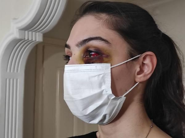 Telefonda video izlediği için kocasından dayak yedi: Ölmeyi mi bekleyeyim? - Resim: 4