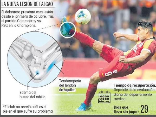 Falcao için olay manşet! Doktorun sözleri ise tam bomba - Resim: 0