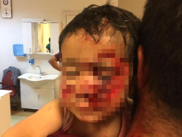 Şanlıurfa'da köpek saldırısına uğrayan küçük Davut, kurtarılamadı - Resim: 0