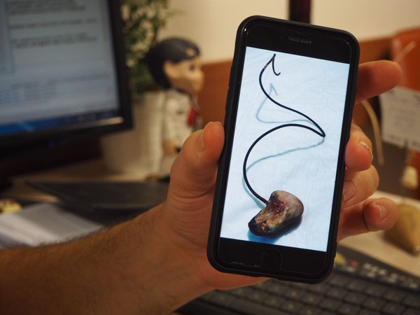 Aydın'da doktor gösterdi şaşkına döndü: İlk kez böyle bir durumla karşılaşıyorum - Resim: 0