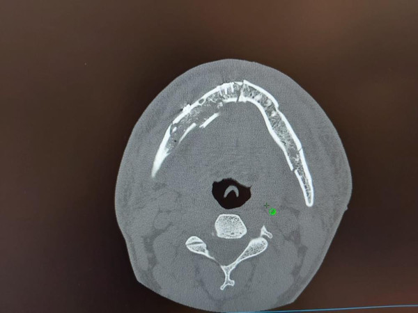 İzmir'de halatın ucundaki kanca çenesini parçalara ayırdı! Operasyon 4 saat sürdü - Resim: 1