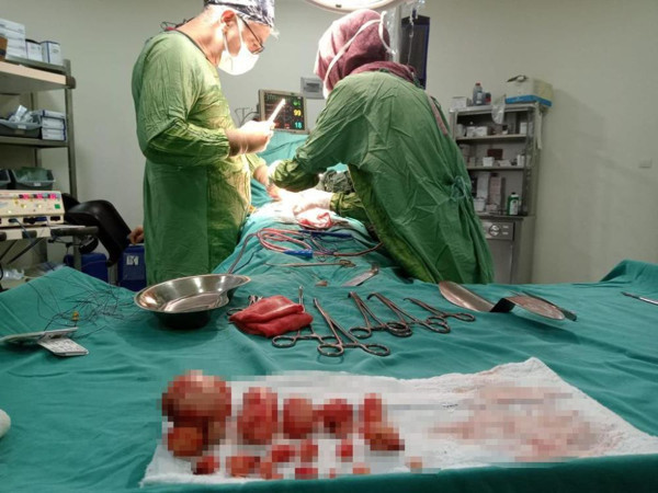 Malatya'da ağrı şikayetiyle hastaneye gitti! Doktorlar şaştı kaldı: Bunlar çok belirti vermez - Resim: 0