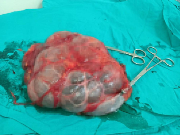 Denizli'de karın ağrısıyla hastaneye gitti! Gerçeği öğrenince şaştı kaldı: Meğer yıllardır... - Resim: 1