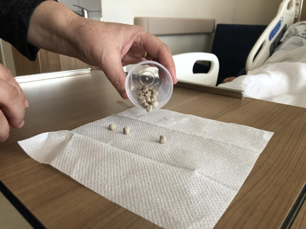 İdrarda zorlanma şikayetiyle hastaneye gitti! Mesanesinden çıkanları görünce inanamadı: Tespih yapacak - Resim: 0