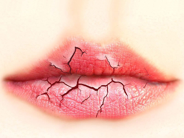 Dudak kuruluğu yaşıyorsanız bu yöntemleri mutlaka deneyin - Resim: 0