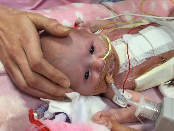 Doktorlar aldır dedi dinlemedi bu halde doğdu - Resim: 2