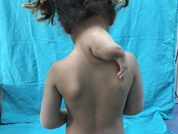 Ensesinden 3. kol çıktı! Doktorlar şoke oldu - Resim: 4