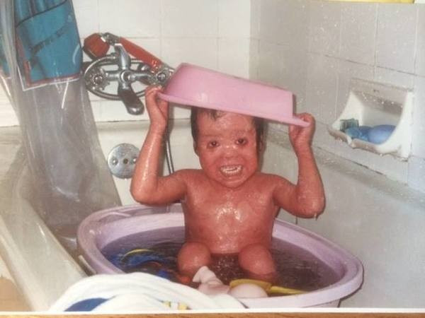 Anne dış görünüşü nedeniyle bebeğini terk etti 20 yıl sonra ise... - Resim: 2