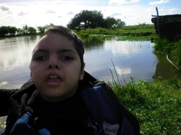 25 yaşındayken engelli bir çocuğu evlatlık edindi daha sonra ise... - Resim: 2