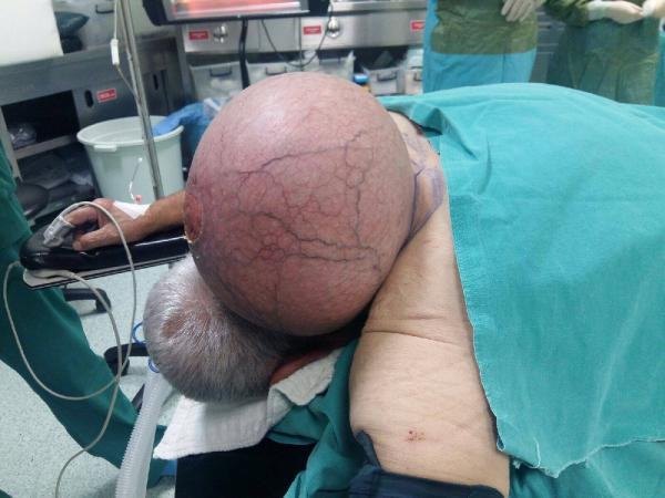 50 yıllık birliktelik ameliyatla son buldu! - Resim: 1