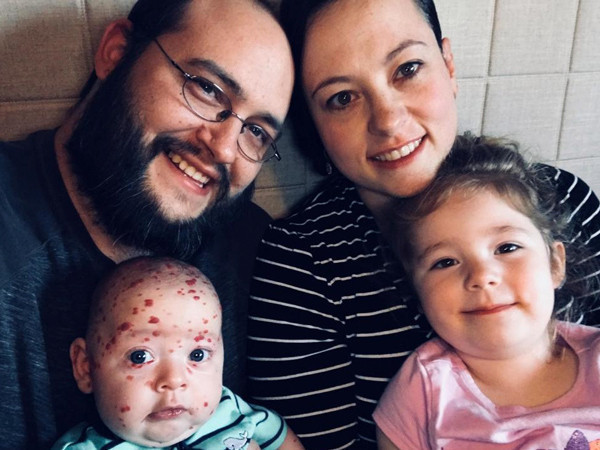 Doktorları bile hayrete düşürdü görenler korkup kaçıyor ama... - Resim: 4