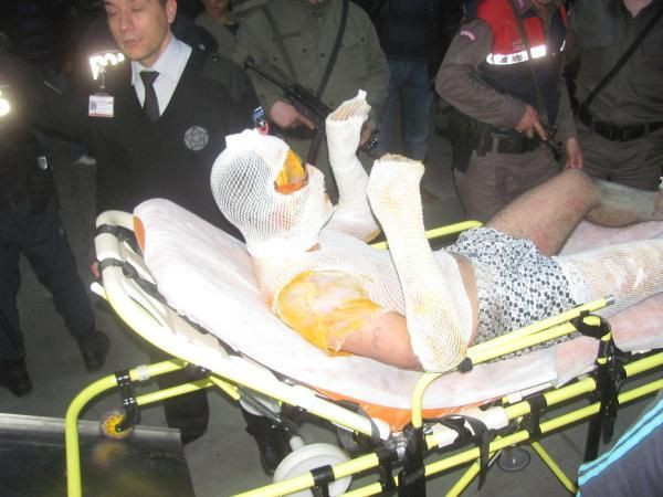 Cezaevinde yangın: 7 yaralı - Resim: 3