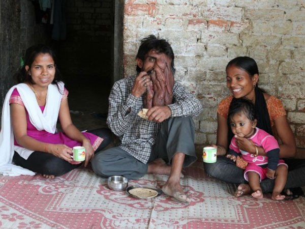 Hindistan'ın Fil Adamı Chana Lal - Resim: 3