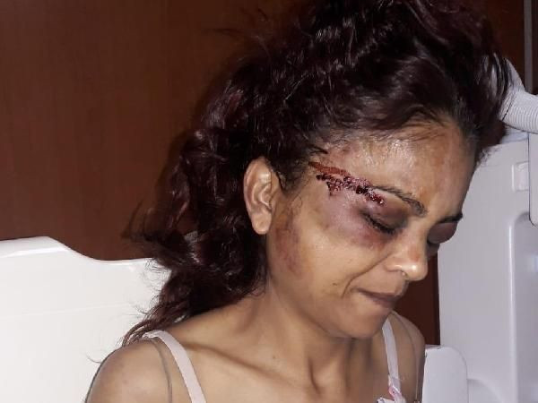 Maaşını vermeyen imam nikahlı eşe feci dayak - Resim: 2