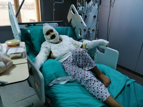 İstanbul'da vahşet! Cezaevinden izinli çıktı eski eşini yağ ile yaktı - Resim: 3