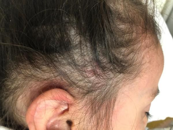 İzmir'de 2,5 yaşındaki kız çocuğu anaokulunda yaşıtları tarafından dövüldü - Resim: 1