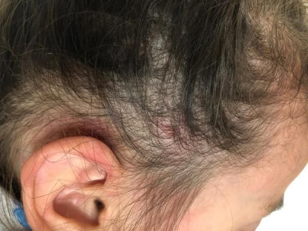 İzmir'de 2,5 yaşındaki kız çocuğu anaokulunda yaşıtları tarafından dövüldü - Resim: 2