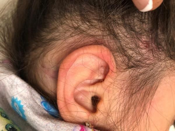 İzmir'de 2,5 yaşındaki kız çocuğu anaokulunda yaşıtları tarafından dövüldü - Resim: 3