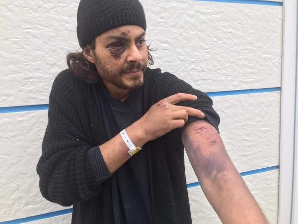 Mültecilere Yunan işkencesi askerler demir çubuklarla dövdü - Resim: 1