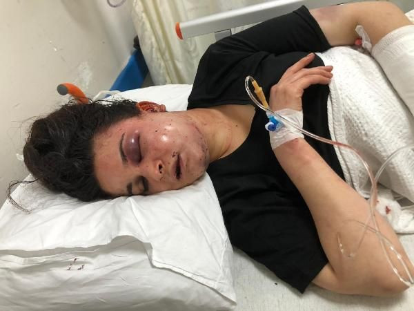 8 saat işkence ettiler! Ya kefen giyeceksin ya da yüzüne kezzabı yiyeceksin... - Resim: 4