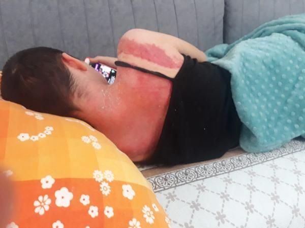 Ümraniye'de üvey anne dehşeti! Kızını kaynar su ile haşlayıp 'yanlışlık oldu' dedi - Resim: 3