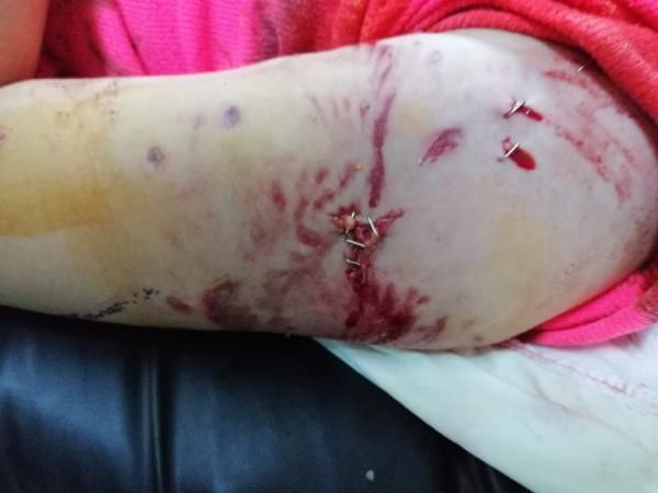 Samsun'da kabus dolu 5 dakika! 12 yaşındaki Tuğba yaşadığı tramvayı atlatamıyor - Resim: 3