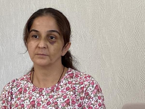 Eskişehir'de eşi kabusu yaşattı! Ayaklarıyla ezdi kafasını duvarlara vurdu: Tuvalete gidip... - Resim: 4