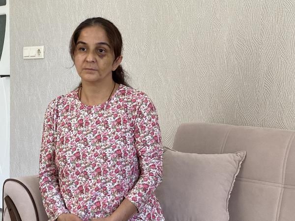 Eskişehir'de eşi kabusu yaşattı! Ayaklarıyla ezdi kafasını duvarlara vurdu: Tuvalete gidip... - Resim: 3