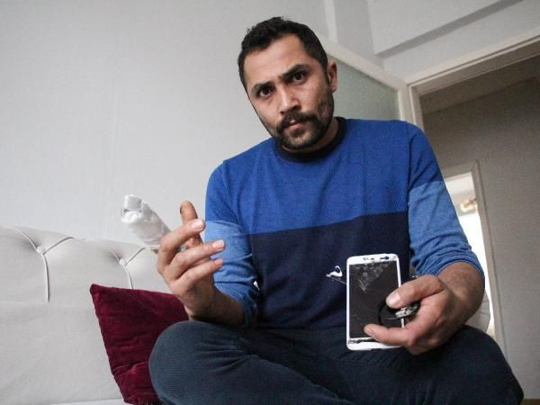Olay yeri Erzurum! Bomba gibi patlayan powerbank parmağını kopardı - Resim: 1