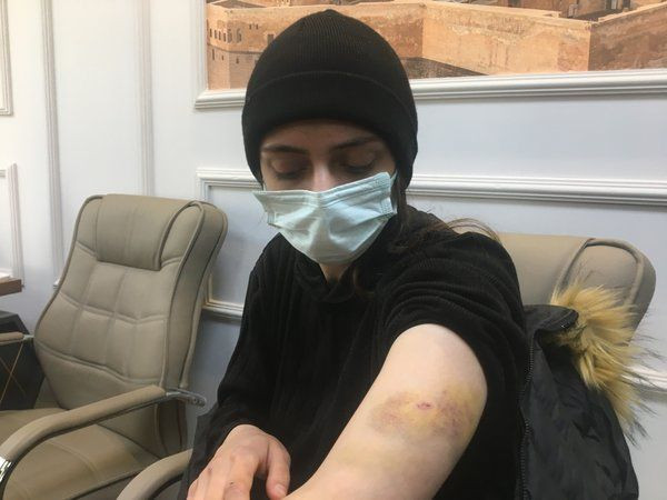 Lüks rezidansta işkence! Çırılçıplak soyup... Cezaevinden çirkin teklif - Resim: 3