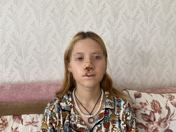 Tacizciler yüzüne kaldırım taşı fırlatmıştı!  O genç kız ilk kez konuştu - Resim: 1