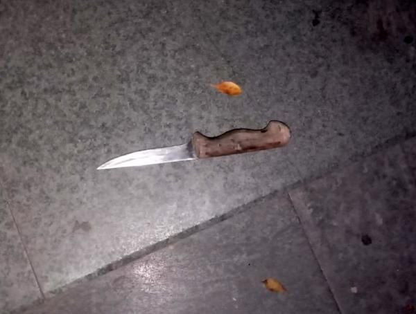 Antalya'da 'Gel sana sarılayım' deyip kalçasından bıçakladı - Resim: 3