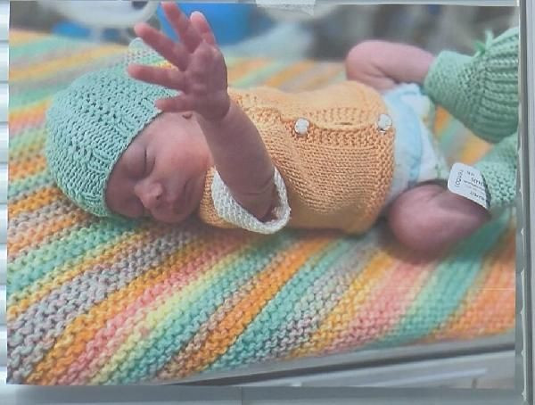 Türk doktorlar mucizeyi başardı! Literatüre girecek: Tıp dünyası bu olayı konuşuyor - Resim: 3