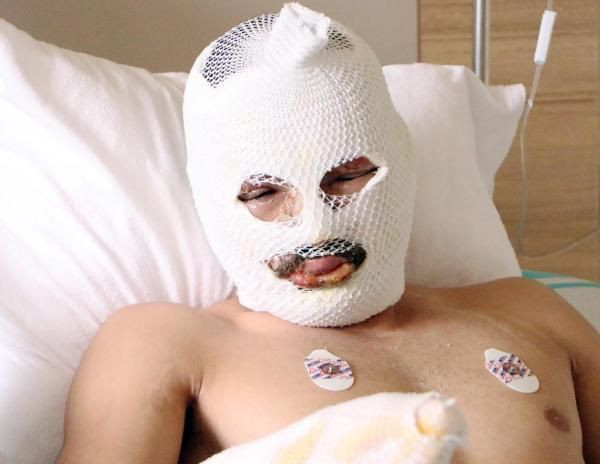 Artvin'de feci olay her şey saniyeler içinde oldu! Canlarını zor kurtardılar - Resim: 3