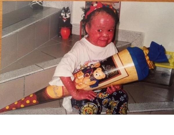 Anne dış görünüşü nedeniyle bebeğini terk etti 20 yıl sonra ise... - Resim: 4