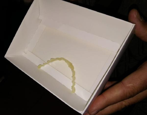 Bursa'da internetten protez siparişi verdi! Gelen ürünü görünce inanamadı: Korkutmaya çalıştılar - Resim: 0