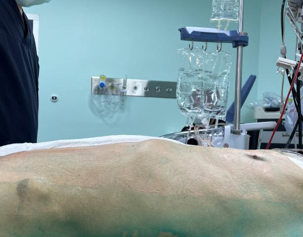 İstanbul'da doktorlar şok oldu literatüre girecek: Saatli bombayla yaşamış - Resim: 3