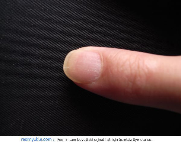 İşaret parmağı hastalık habercisi - Resim: 4