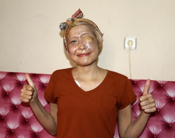 İlik bekleyen Yağmur'a korona engeli! Yüzde 99 uyuyor ama Almanya'dan gelemiyor - Resim: 3