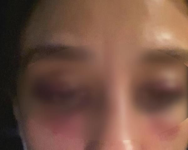 RUBATO'nun solisti Özer Arkun sevgilisini dövdü kan izlerini sildiği görüntüler ortaya çıktı - Resim: 3