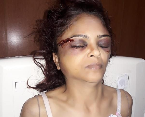 Maaşını vermeyen imam nikahlı eşe feci dayak - Resim: 1