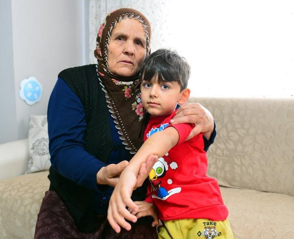 Rottweiler'ın saldırdığı minik Almila ölümden döndü - Resim: 4