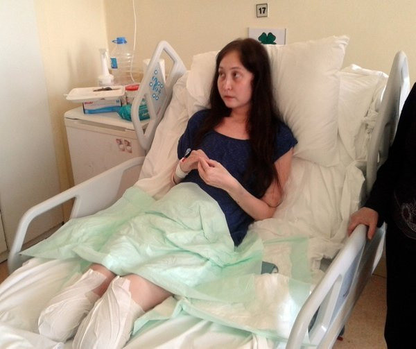 Estetik ameliyat sonrası felaket! Burun ameliyatı oldu bacakları kesildi - Resim: 1