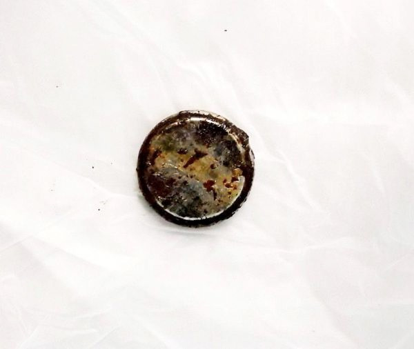 Küçük Efe pil yutunca olanlar oldu - Resim: 1