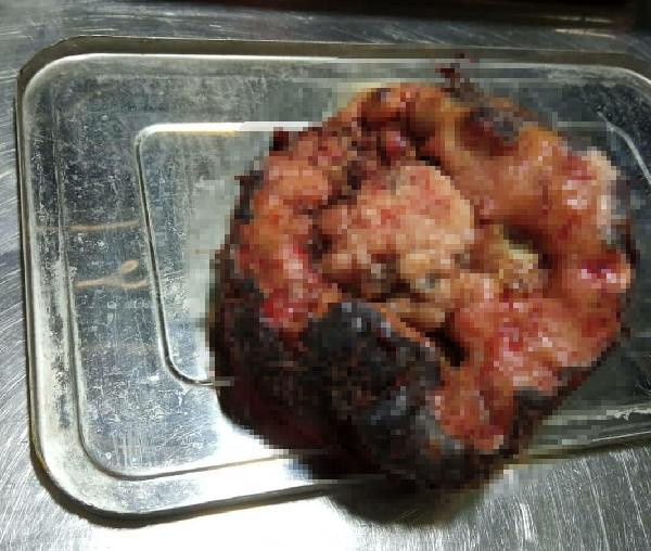 İzmir'de görenler çok üzülmüştü! 2 saatte çıkarıldı büyüklüğü şaşırttı - Resim: 0