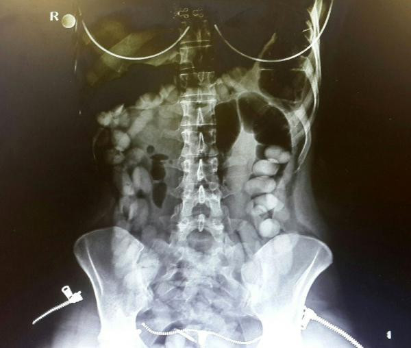 Duyan şok oldu! 5 bin dolar alıp 2 günde yutmuş - Resim: 4